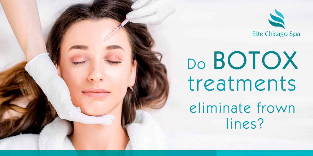 You are currently viewing Do botox treatments eliminate frown lines?