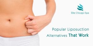 Read more about the article Liposuction alternatives: Do fat-reduction devices work?