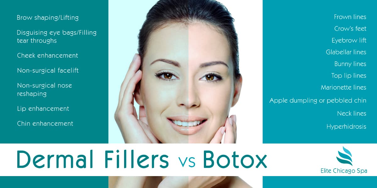 Read more about the article Difference between dermal fillers and botox