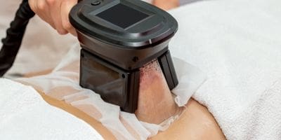coolsculpting and surgeons