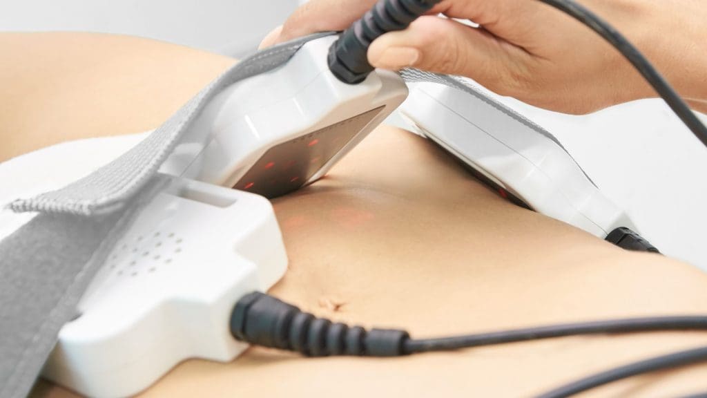 best laser liposuction