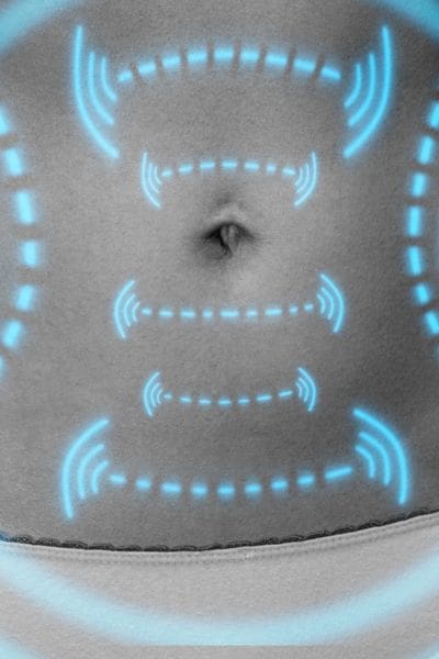 laser fat removal no need surgery