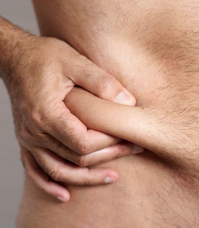 Radiofrequency Fat Reduction Work