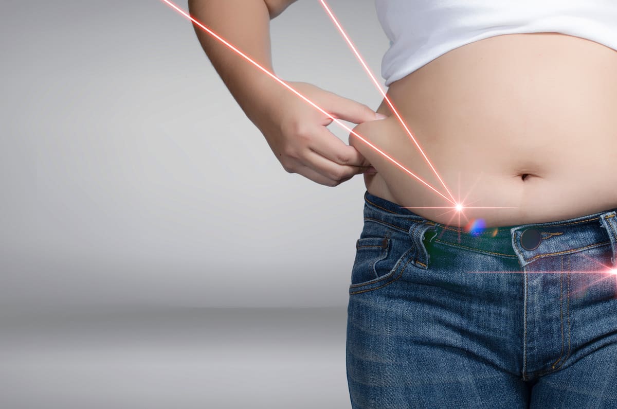 You are currently viewing What you Should Know Before Having Laser Liposuction