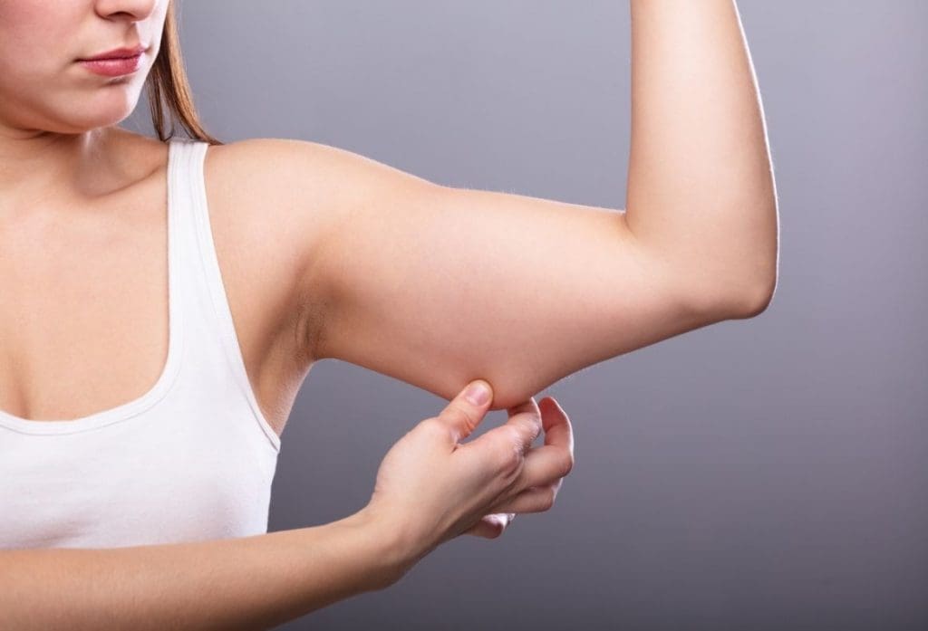 Radiofrequency or Coolsculpting
