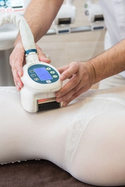laser lipolysis