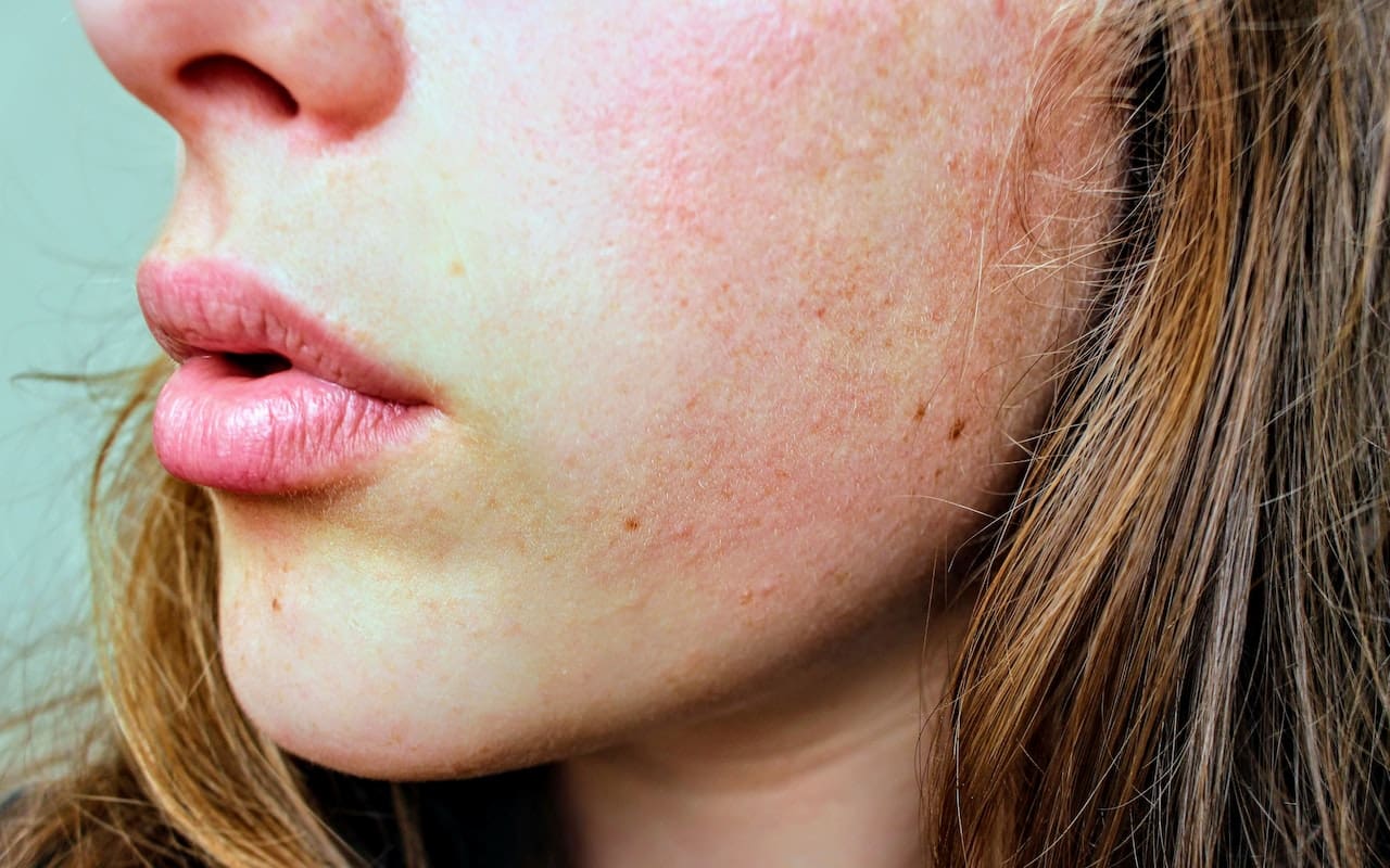 You are currently viewing Connection Between Diet And Skin