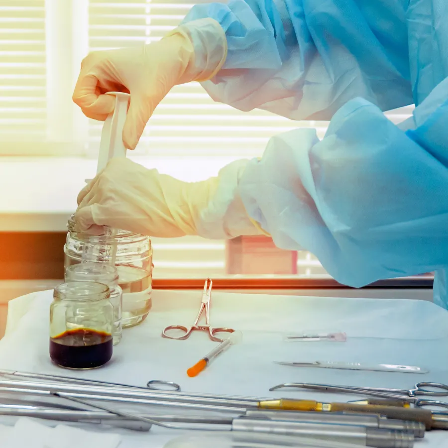 laser-liposuction-cannula-how-does-it-work-operation