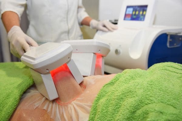 coolsculpting elite how long do results last