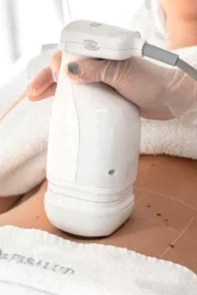Liposonix Chicago IL