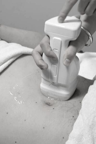 Liposonix in Chicago Illinois