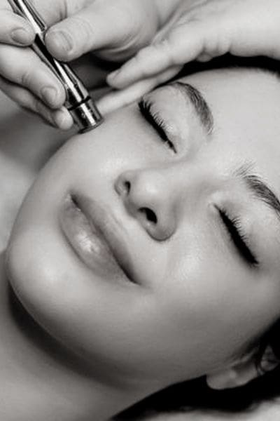 microderm with enzyme in chicago il
