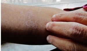 Read more about the article Skincare For Weather Changes: Tips For Health Care
