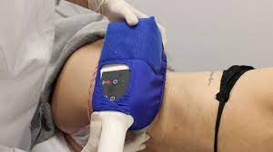 Excellent Coolsculpting in Oak Park IL