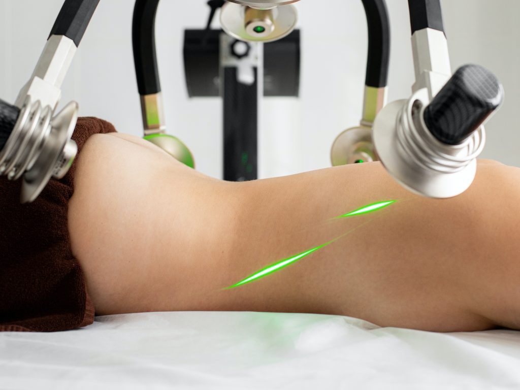 Laser lipo procedure