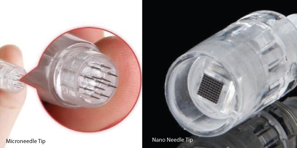 Are There Any Age Restrictions For Undergoing Nano Needling - microneedling vs nanoneedling