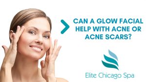 Read more about the article Can A Glow Facial Help With Acne Or Acne Scars?