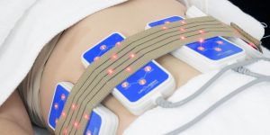 Read more about the article Factors Influencing Lipolaser Efficacy