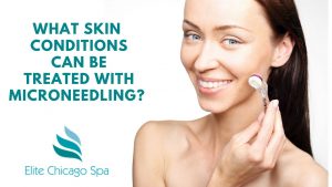 Read more about the article What Skin Conditions Can Be Treated With Microneedling?