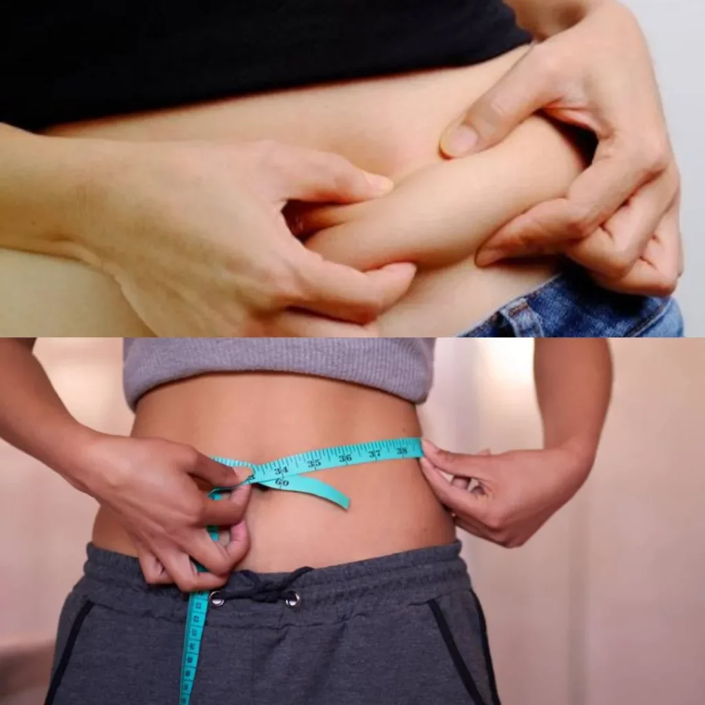 before-and-after-coolcculpting-tips