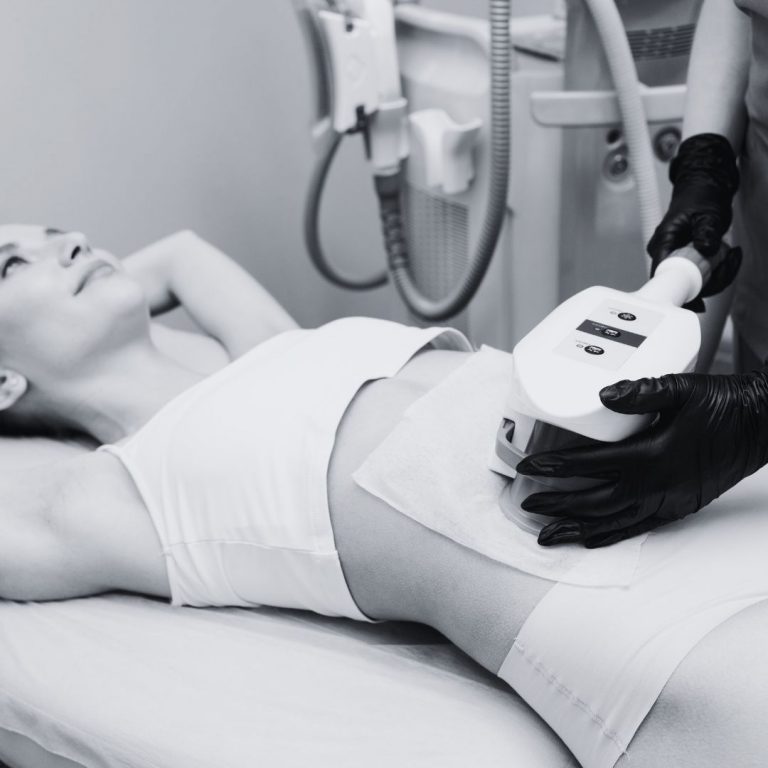 Best Coolsculpting Chicago
