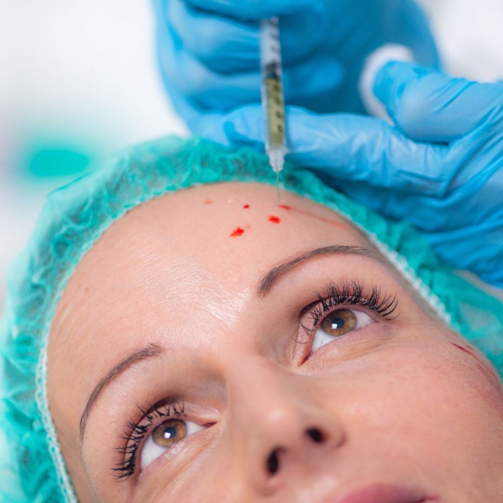 Microderm Deals in Chicago