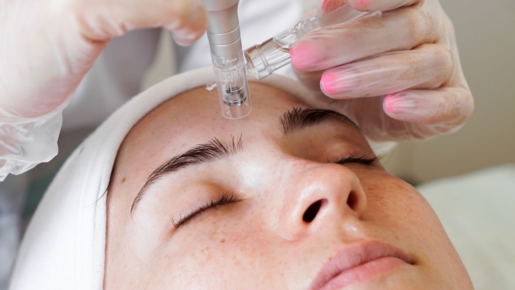 Read more about the article What Areas Of The Body Can Treat With Nano Needling?