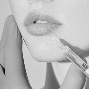 elite-chicago-spa-lip-fillers-in-chicago-illinois-usa