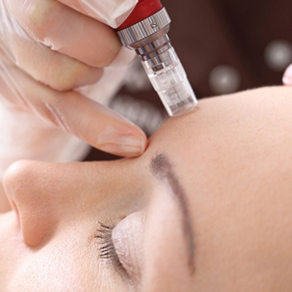 Glow facial Elmwook Park IL