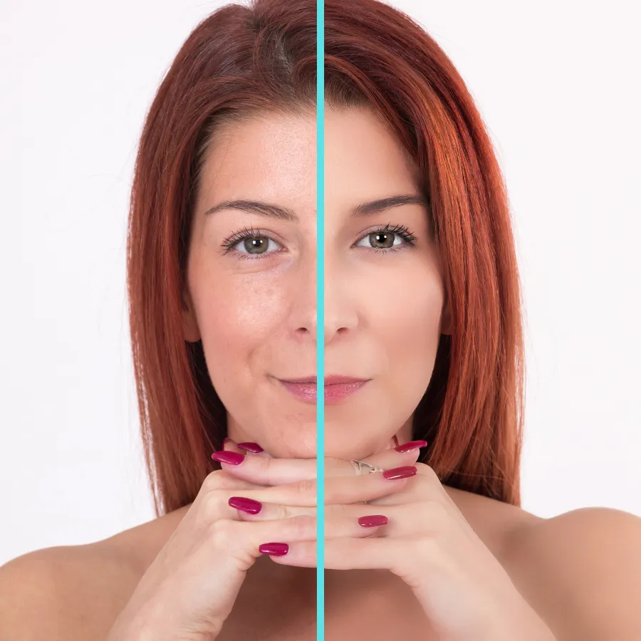 revitalize-your-skin-with-microdermabrasion