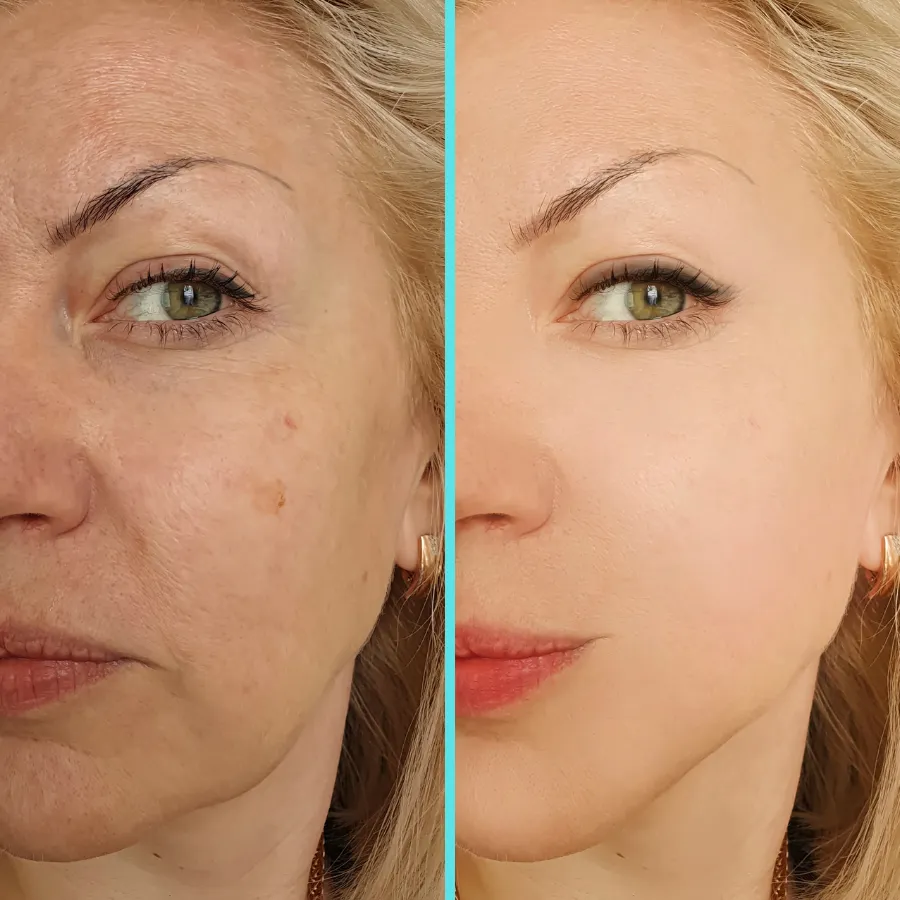 revitalizing-with-prp-healing-benefits