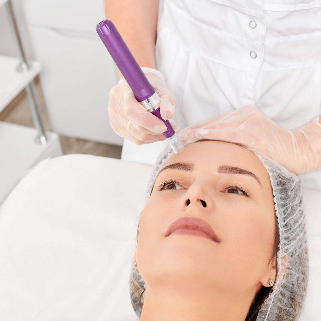 elite spa can any restrictions to get nano needling