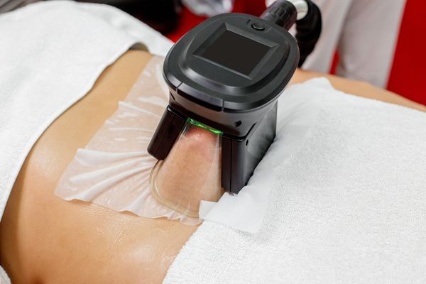 how-long-do-coolsculpting-results-last