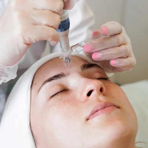 diamond-glow-vs-dermabrasion-difference