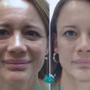 Hydrating Facial