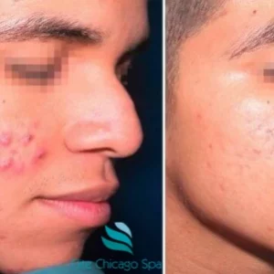 Men’s Facial